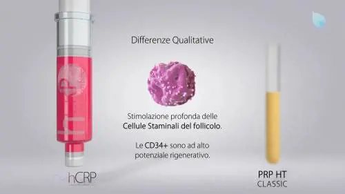 Differenze tra PRP capelli e Protocollo bSBS