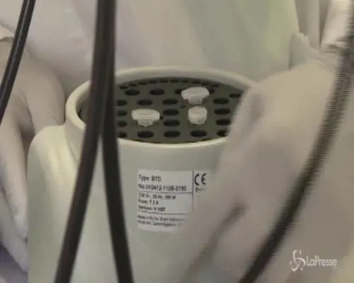 Hiv, parte la sperimentazione del vaccino pediatrico