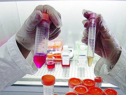 Staminali, ok primi test per Sla: trapiantate cellule su sei pazienti