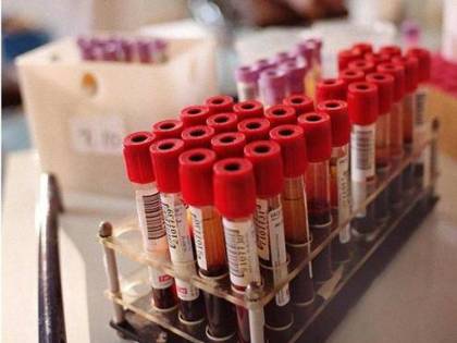 Assenteisti per donare sangue, Avis: "Isolare i furbacchioni"