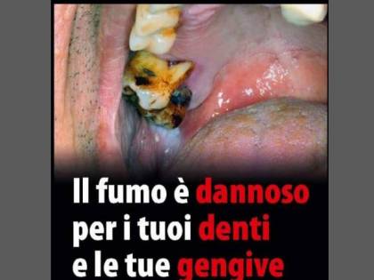 Le foto choc sui pacchetti di sigarette