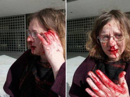 Atene, l'avvocato dei migranti aggredita da Alba Dorata