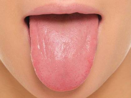 La nuova (e folle) moda dei giovani? La lingua biforcuta. E i medici: "Pericoloso per la salute"