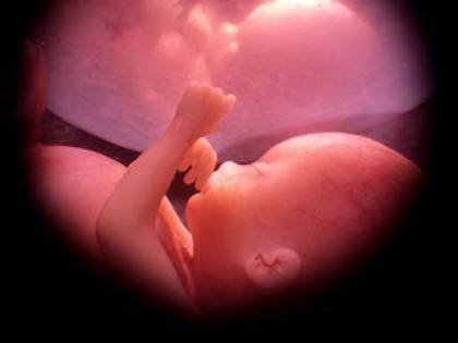 Pure la Louisiana vieta l'interruzione di gravidanza: "No aborto se c'è battito"