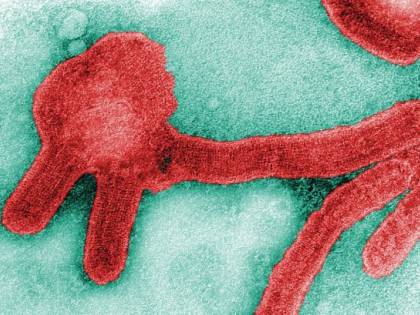 Gli Usa vogliono il vaccino per il virus Marburg, variante letale dell'Ebola