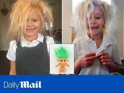 Wynter Seymour, la bambina con la "Sindrome di Pierino Porcospino"