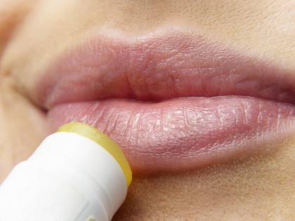 Il legame tra herpes labiale e morbo di Alzheimer