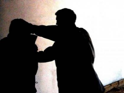 Modena, tenta di sfigurare con l'acido l'ex e il nuovo compagno
