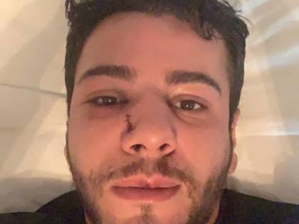 "Sei gay". E lo pestano a sangue. La denuncia su Facebook