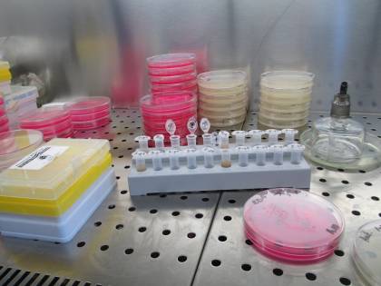 Alzheimer, un anticoagulante può ritardare i sintomi