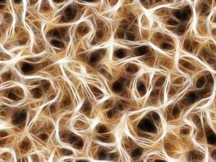 Morbo di Alzheimer: approvato in Cina farmaco a base di alga bruna