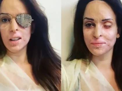 La sfregiò con l'acido, pena definitiva per l'ex di Gessica