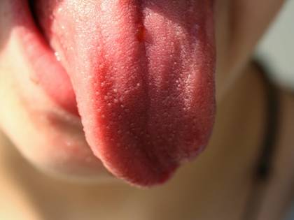 La lingua "cartina di tornasole" del benessere