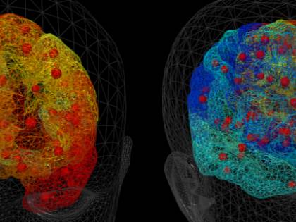 La fisica per curare le malattie: così crea cervelli umani virtuali