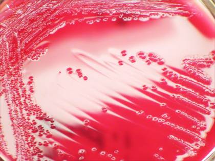 Shigella, il batterio responsabile della dissenteria