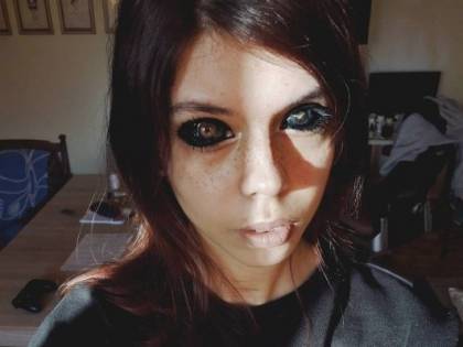 Tatuaggi sugli occhi e perde la vista
