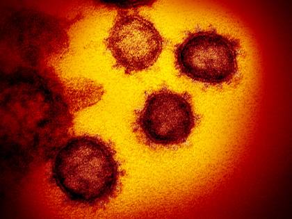 Ecco qual è l'anticorpo "bomba" che può fermare l'incubo Covid