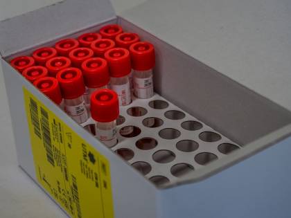 Tamponi, appello dei laboratori privati. "Pronti ai test, le Regioni tentennano"
