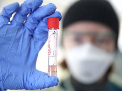 Ecco i test di massa sugli anticorpi: si scoprirà chi ha avuto il virus