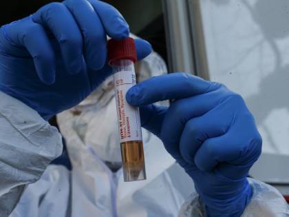 Test della speranza anti Covid: trova i positivi prima dei sintomi