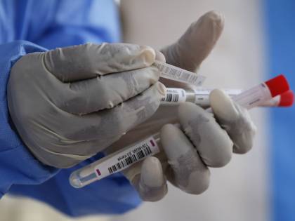 "Ogni ora migliaia di test sugli anticorpi. Così sapremo chi potrà tornare attivo"