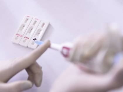 Ecco cosa sono e come funzionano i test sierologici