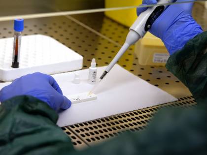 La spia dei linfociti nel sangue: l'identikit dei soggetti a rischio