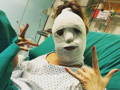 Foto choc di Gessica Notaro dopo l'attacco con l'acido: "Mi ha salvato la mia follia"