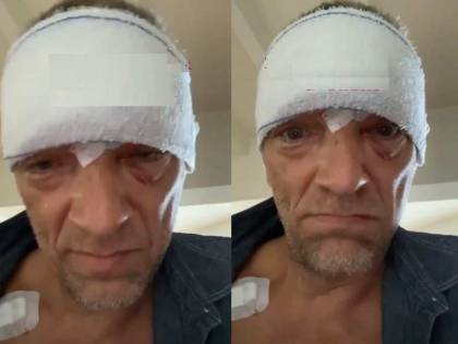 Paura per Vincent Cassel: un brutto incidente gli provoca un trauma cranico