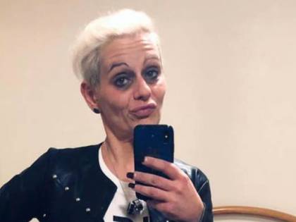 Stalkerizzato e sfregiato con l'acido ma per i giudici non c'è premeditazione