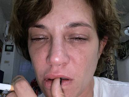 Lo strazio social di Asia Argento: "Volete il dolore? Eccolo"
