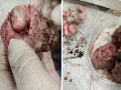 In carcere "carne allucinogena". Così arriva la droga ai detenuti