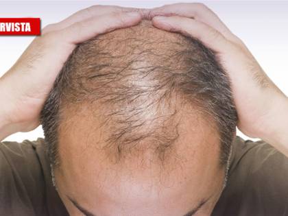 Il virus e il legame coi capelli: "Colpisce di più chi non li ha"