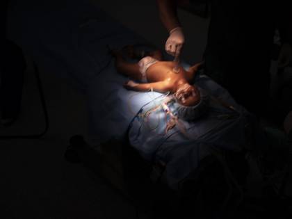 Il traffico di organi fa paura: le persone spariscono nel nulla