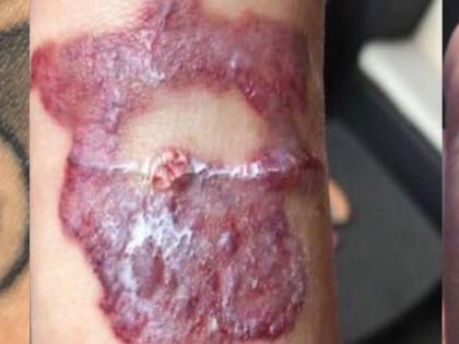 Schiaffo dei giudici all'agente: via per un vecchio tatuaggio