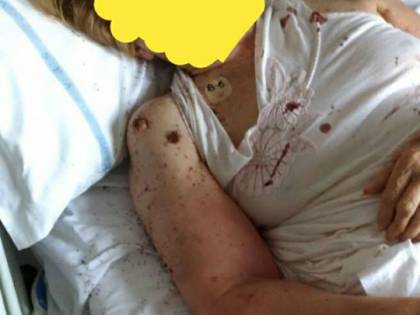 Napoli, le formiche in ospedale: 17 gli indagati