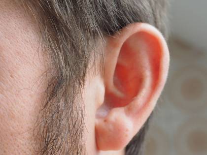 Covid, studio dimostra che può provocare perdita dell'udito