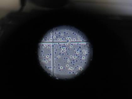Gli 007 frenano gli allarmisti: "L'epidemia? Ora è gestibile"