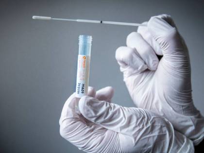 Cambiano i test per la definizione dei nuovi casi di coronavirus