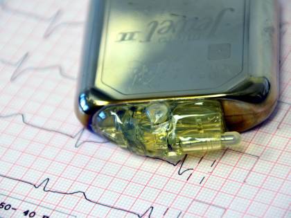Pacemaker, così smartphone e fitness tracker ne alterano il funzionamento