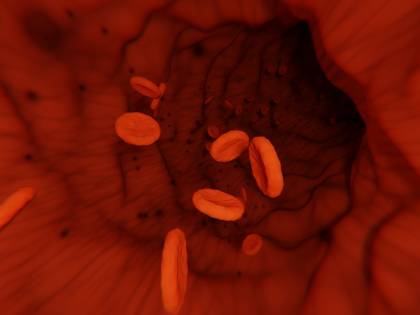 Contro il mieloma multiplo, una nuova terapia riaccende le speranze