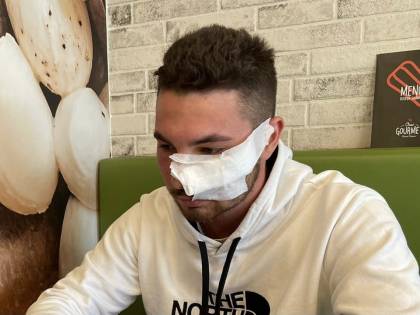 Il rider sfregiato: "Mi ha chiamato solo Salvini. La sinistra? In silenzio" Il rider sfregiato: "Mi ha chiamato solo Salvini. La sinistra? In silenzio"