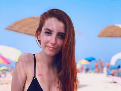 Sarah e la malattia che aggredisce le ossa: cos'è la sindrome di Ehlers Danlos
