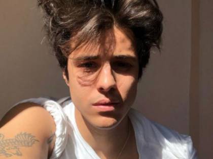 Michele non ce l'ha fatta: la giovane star di "Amici" uccisa da una leucemia