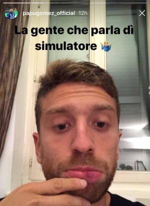 Il Papu Gomez mostra il labbro spaccato su Instagram: "Altro che simulatore"