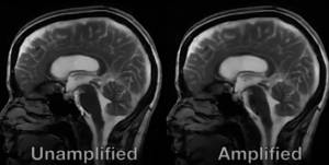 Il cervello "batte" come il cuore: il movimento ripreso per la prima volta