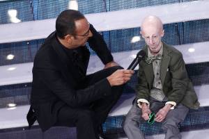 Un'altra vittoria per Sammy Basso: il 22enne affetto dalla sindrome dell'invecchiamento precoce si è laureato