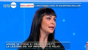 Valentina Dallari rivela: "Sul web mi chiesero di non ridere più, mi ha segnato"