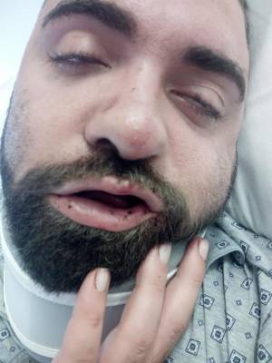 Taranto, le immagini dell'uomo in ospedale dopo l'aggressione