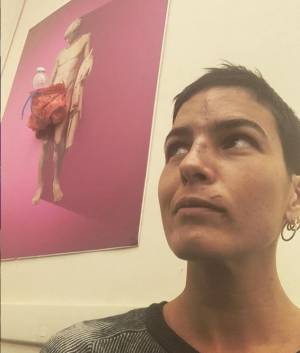 "Mi sono ritrovata senza naso": la confessione dell’ex Miss Italia